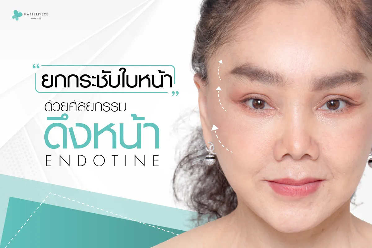 ดึงหน้า Endotine ยกกระชับใบหน้าด้วยศัลยกรรม