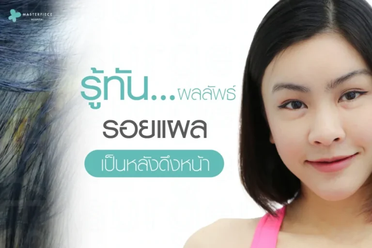 รู้ทัน…ผลลัพธ์ รอยแผลเป็นหลังดึงหน้า