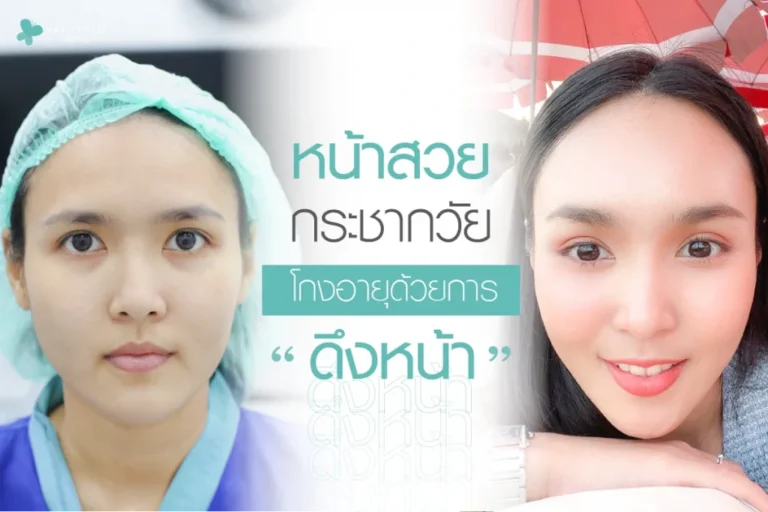 หน้าสวยกระชากวัย โกงอายุด้วยการ “ดึงหน้า”